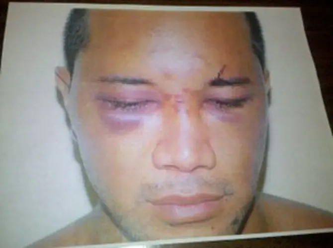 Allegations of police cover-up persist