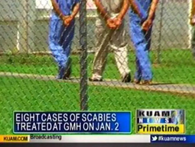 Eight cases of scabies treated at GMH