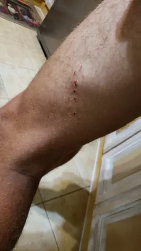 Surfer gets nipped by shark in Talofofo Bay