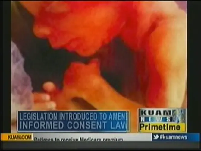 Legislation amends informed consent law