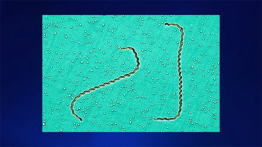 Three more cases of leptospirosis