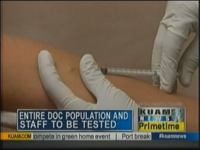 DOC, Public Health begin mass TB testing