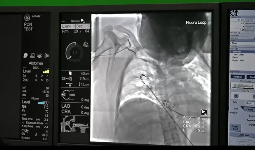 GMH's new angiosuite provides cutting edge technology, first in the region