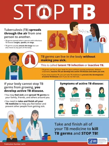 Guam Department of Education, Public Health report tuberculosis case at Simon Sanchez High School