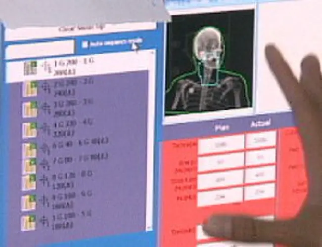 Island Cancer Center offers concentrated radiation treatment