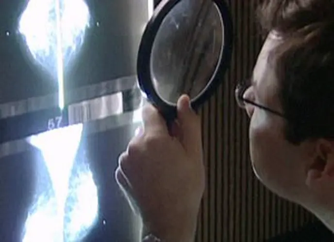 Radiologist stresses importance of mammograms