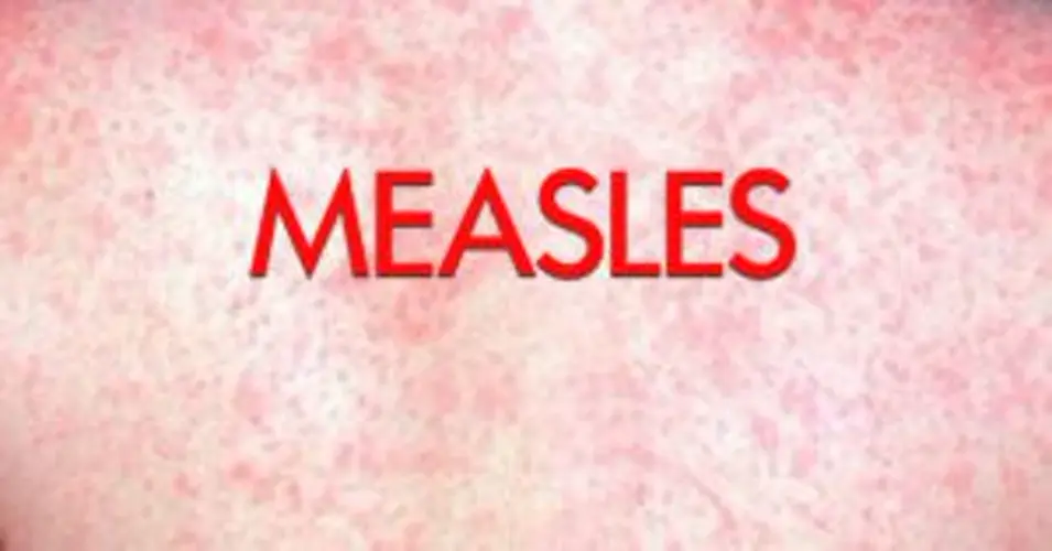 CDC Recommending Measles Vaccination