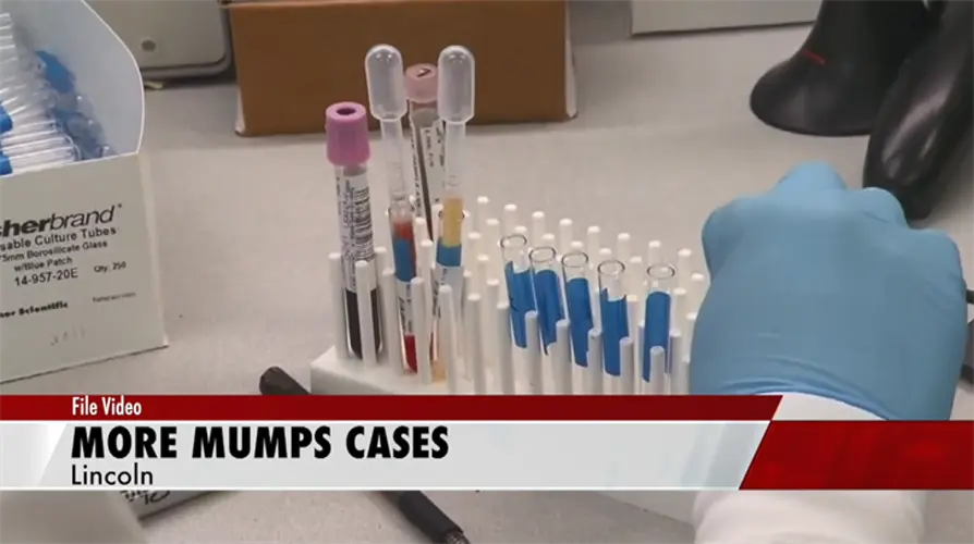 Mumps cases on the rise in Lancaster County