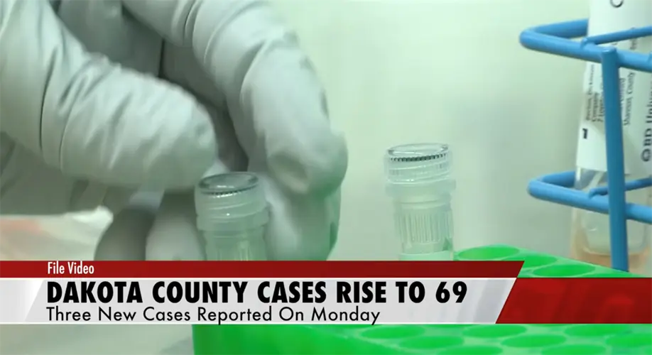 Dakota County Cases Rise to 69