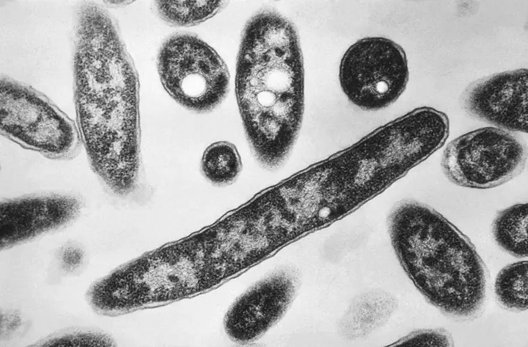 New diagnoses slow in NYC Legionnaires' disease outbreak; source still unclear