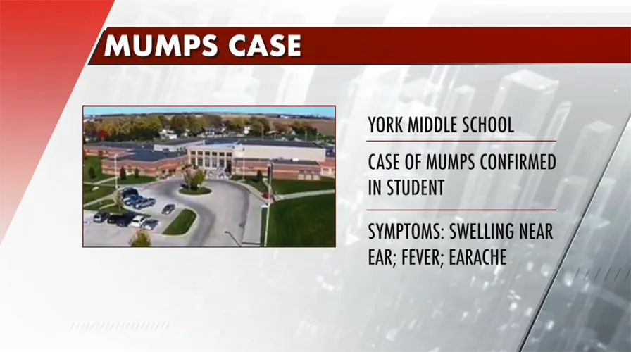 Mumps case confirmed in York Middle School student
