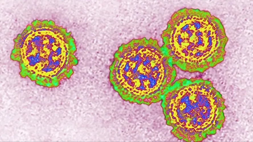 Flu 'widespread' in Columbus, throughout state