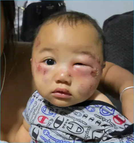 Baby boy badly injured at Tamuning daycare, mom and grandmother speak out